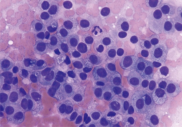 kjpathol-47-93-g005.jpg