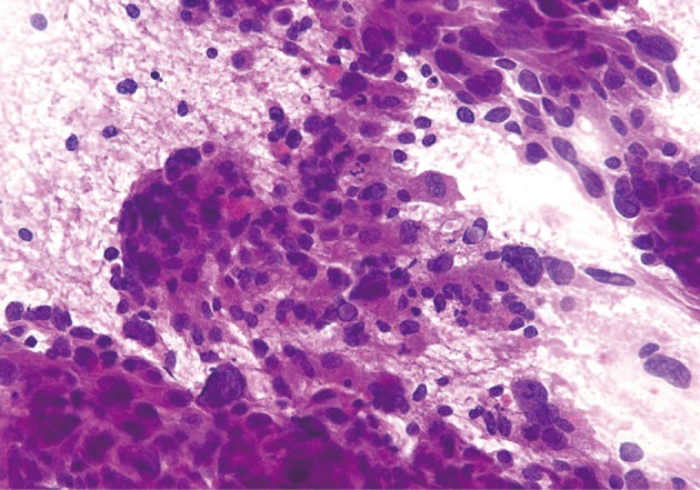 kjpathol-47-93-g008.jpg