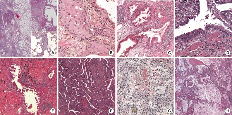 kjpathol-48-10-g002.jpg