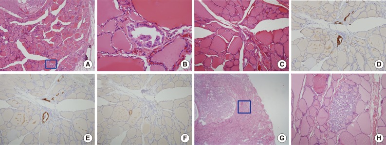 kjpathol-48-117-g001.jpg