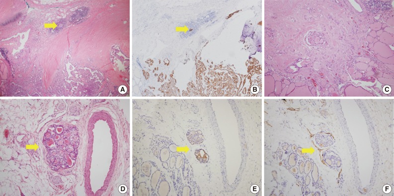 kjpathol-48-117-g002.jpg