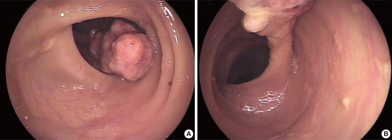 kjpathol-48-140-g001.jpg