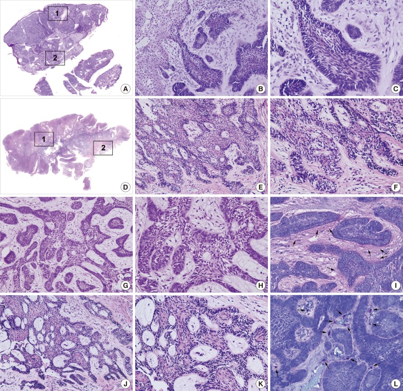 kjpathol-48-151-g001.jpg