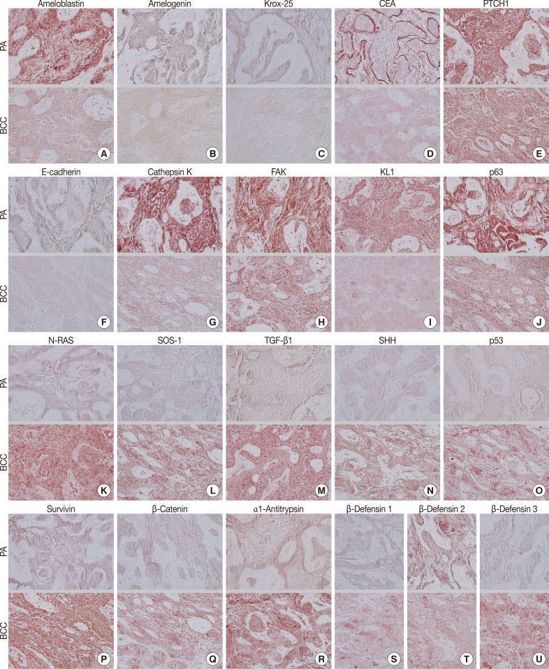 kjpathol-48-151-g002.jpg