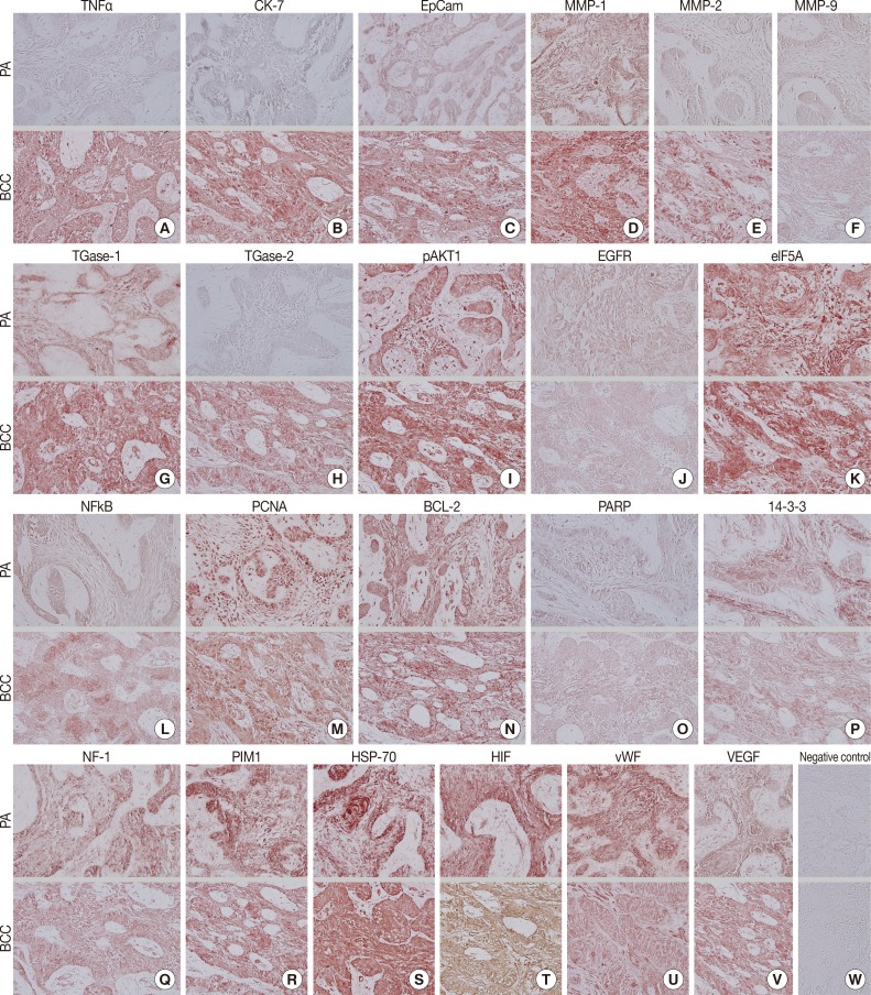 kjpathol-48-151-g003.jpg