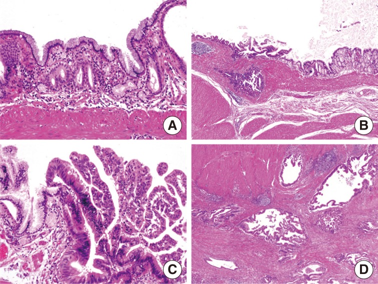 kjpathol-48-159-g002.jpg