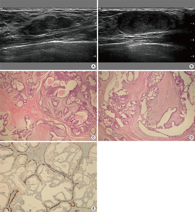 kjpathol-48-164-g001.jpg