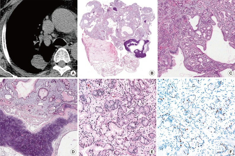 kjpathol-48-167-g001.jpg