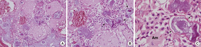 kjpathol-48-175-g001.jpg
