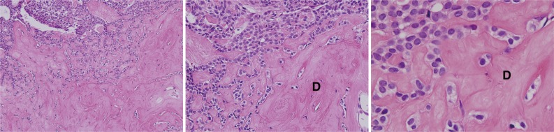 kjpathol-48-175-g003.jpg
