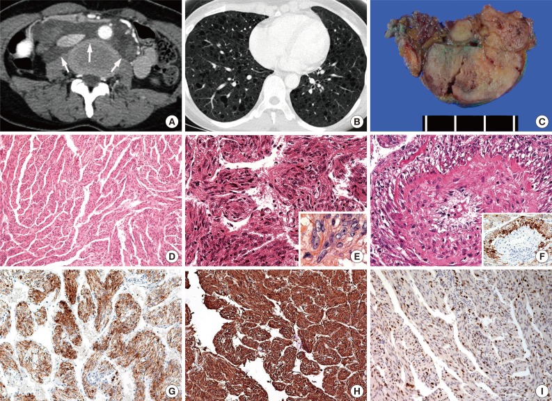 kjpathol-48-188-g001.jpg