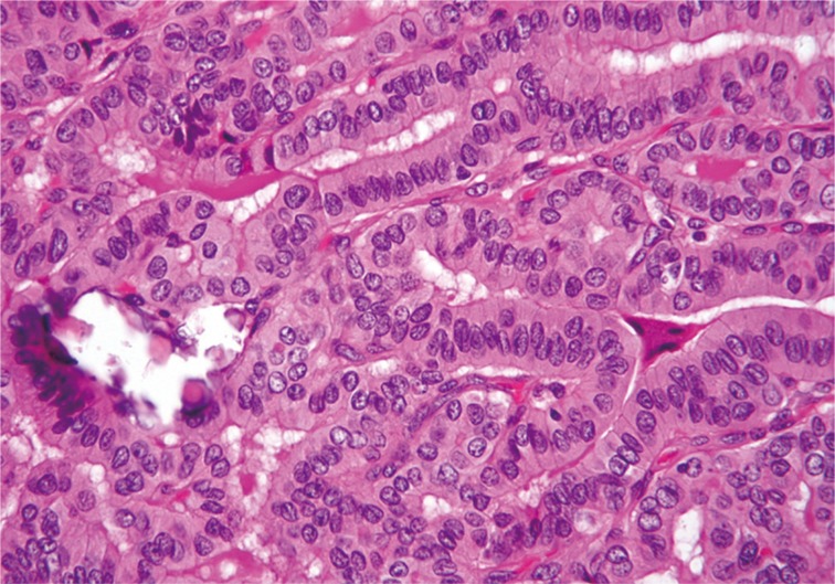 kjpathol-48-201-g001.jpg