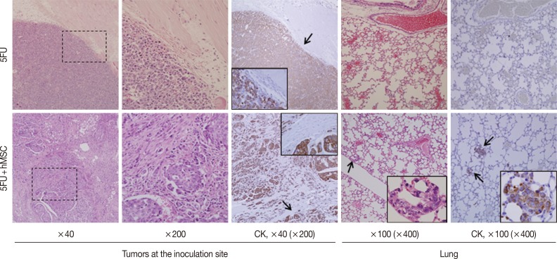 kjpathol-48-217-g003.jpg