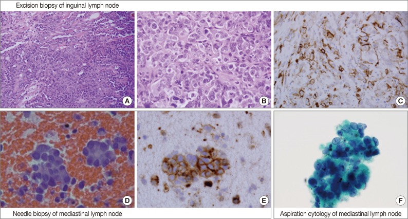 kjpathol-48-241-g001.jpg