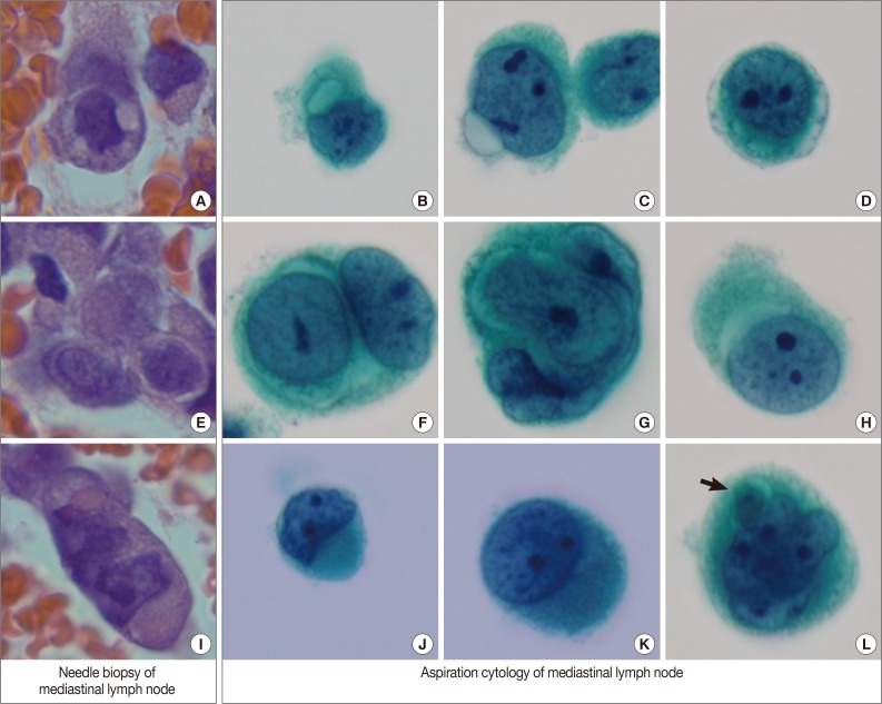 kjpathol-48-241-g002.jpg