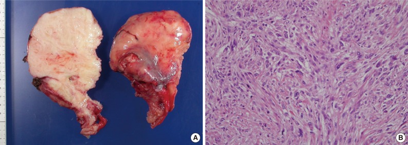 kjpathol-48-250-g002.jpg