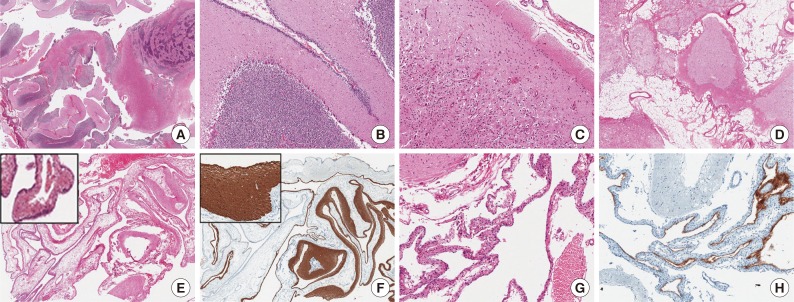 kjpathol-48-254-g002.jpg