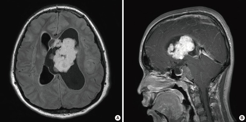 kjpathol-48-302-g001.jpg