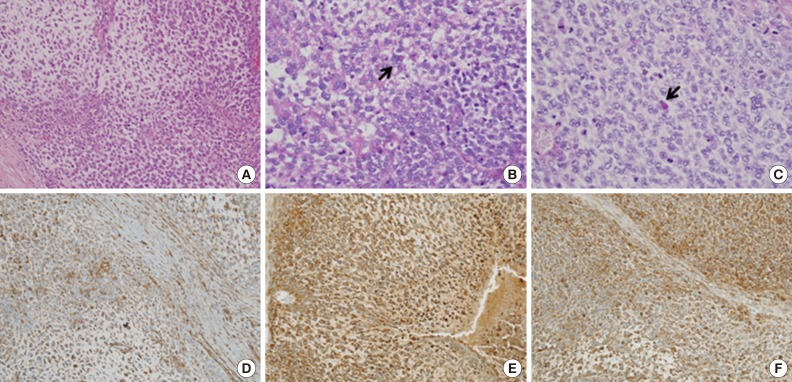 kjpathol-48-311-g003.jpg