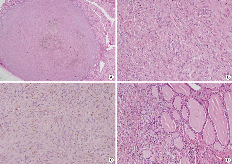 kjpathol-48-319-g002.jpg