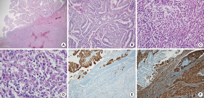 kjpathol-48-327-g002.jpg