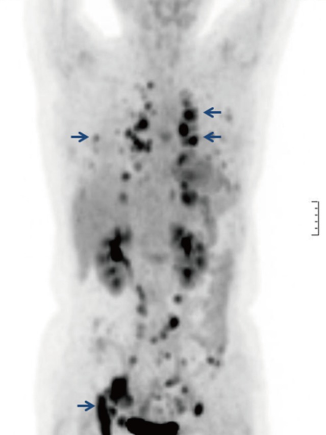 kjpathol-48-327-g003.jpg