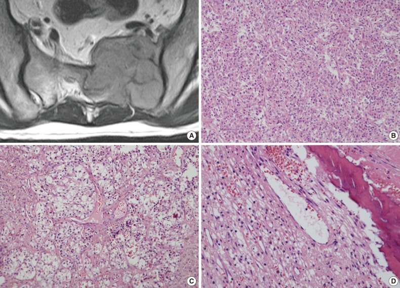 kjpathol-48-331-g001.jpg