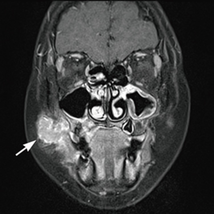 kjpathol-48-335-g001.jpg