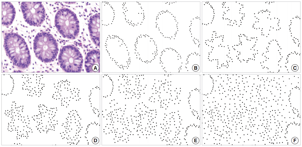 kjpathol-48-5-339f1.jpg