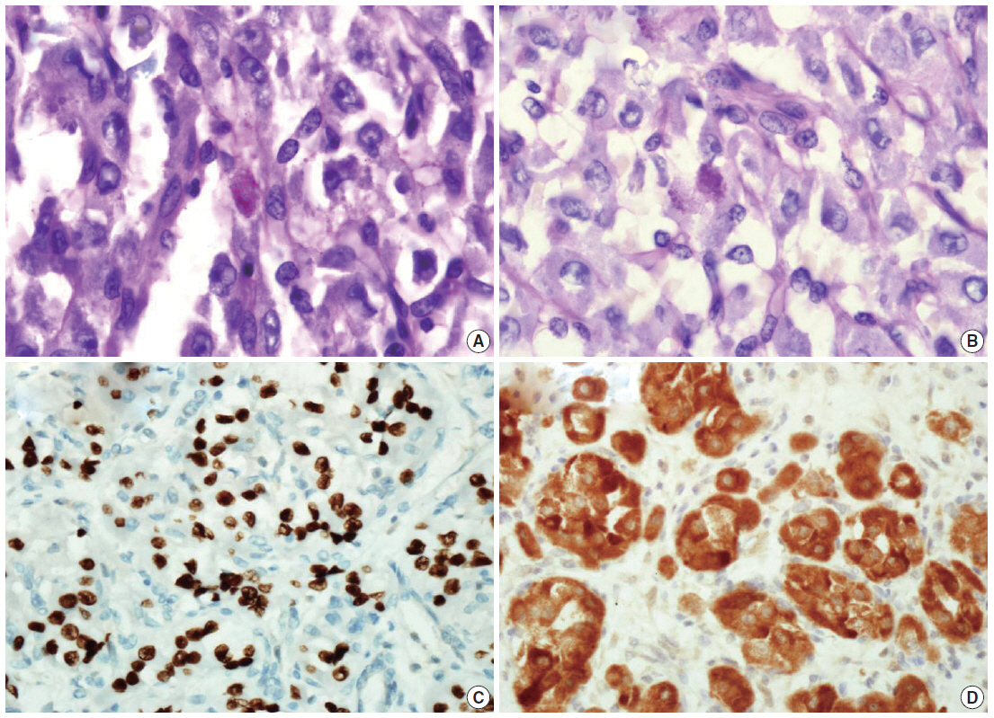 kjpathol-48-5-361f3.jpg