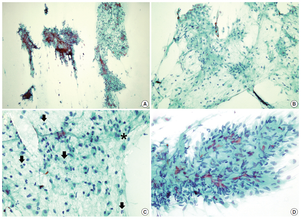 kjpathol-48-5-366f2.jpg