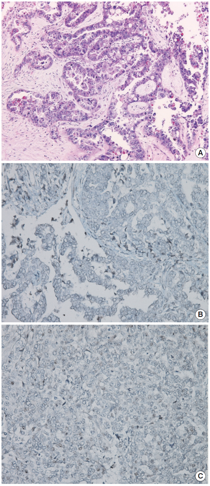 kjpathol-48-5-379f2.jpg