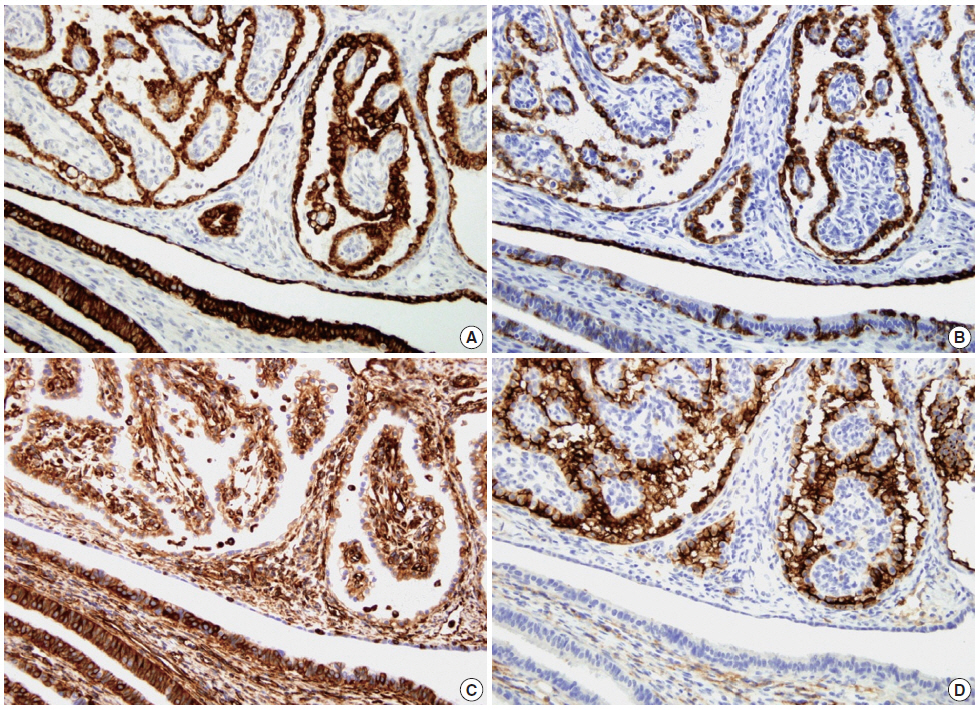 kjpathol-48-5-382f3.jpg