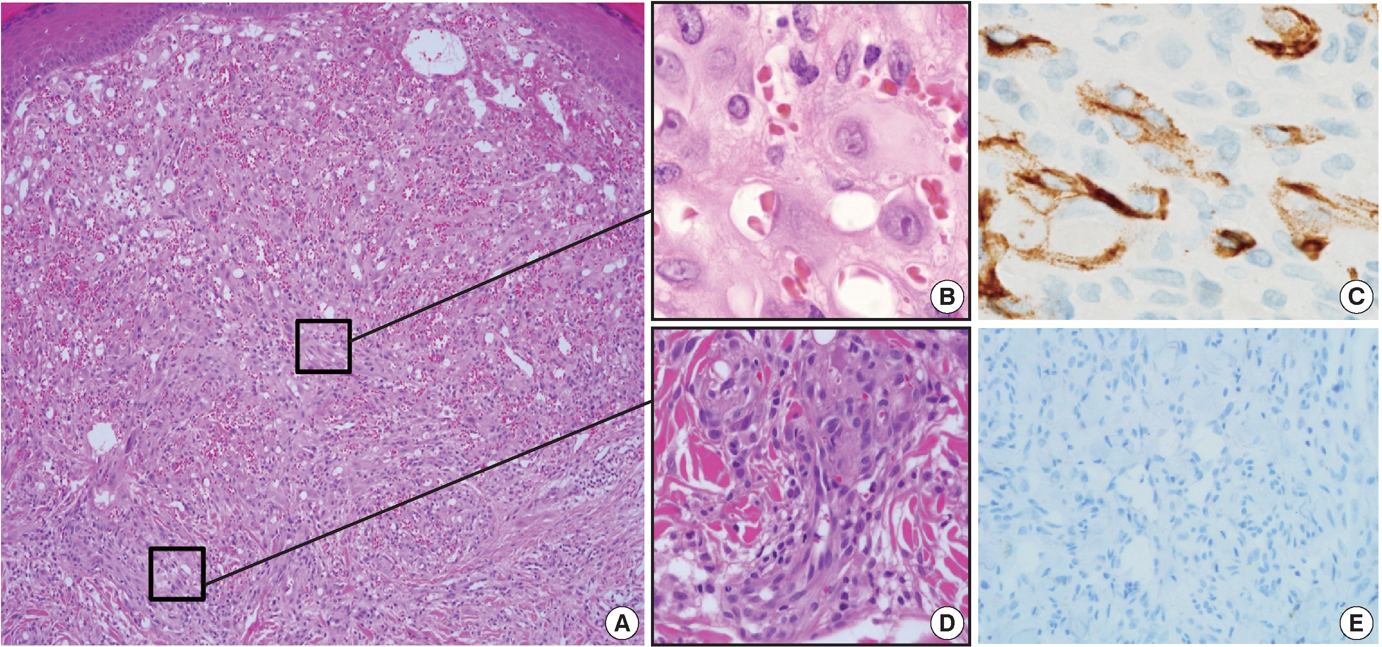 kjpathol-48-5-394f2.jpg