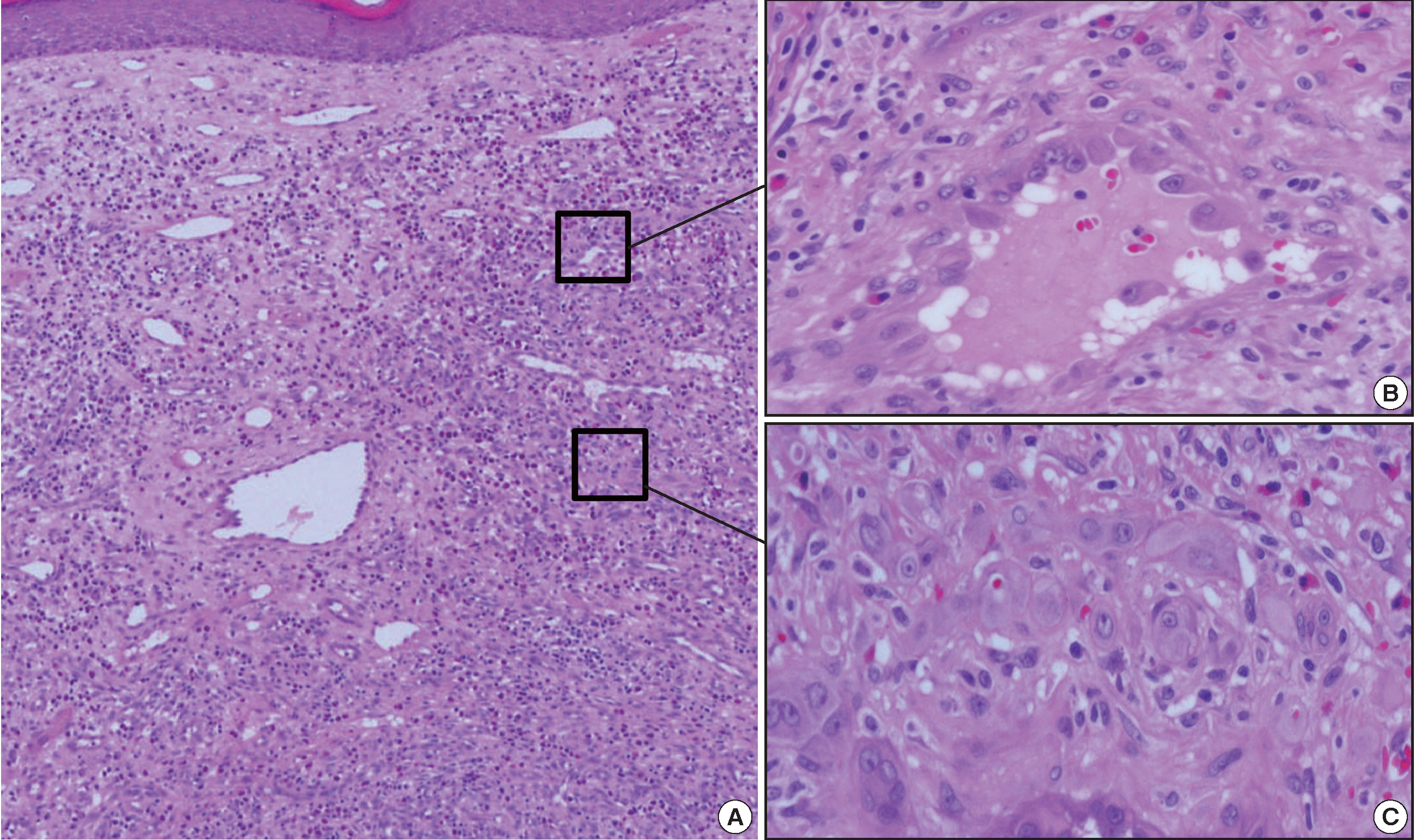 kjpathol-48-5-394f3.jpg