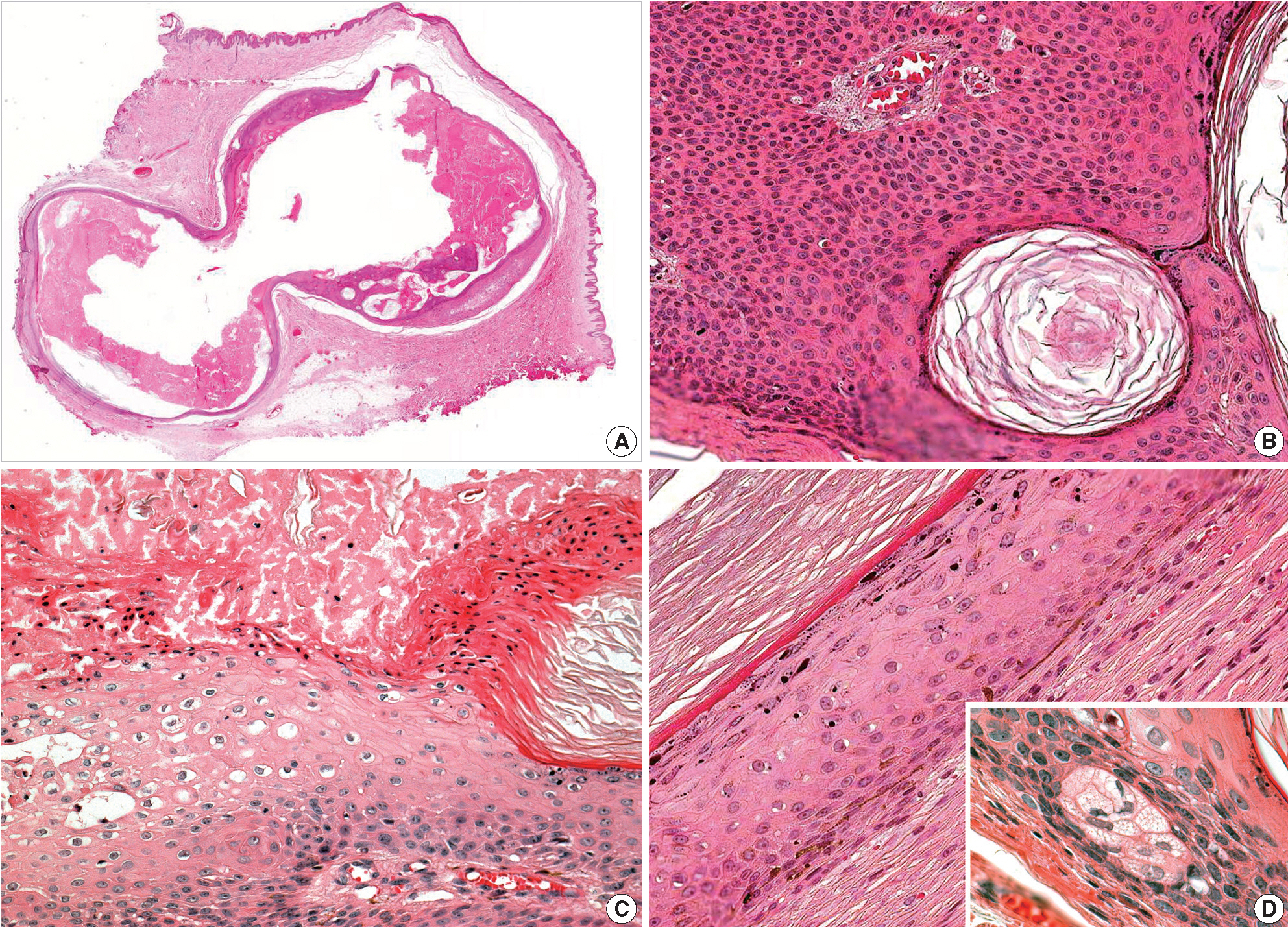 kjpathol-48-5-398f1.jpg