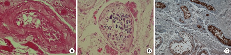 kjpathol-48-50-g004.jpg