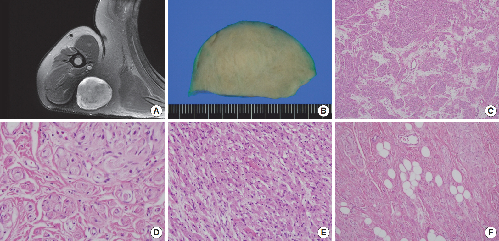 kjpathol-48-6-409f1.jpg