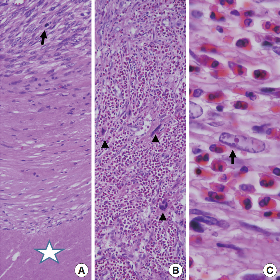 kjpathol-48-6-423f2.jpg