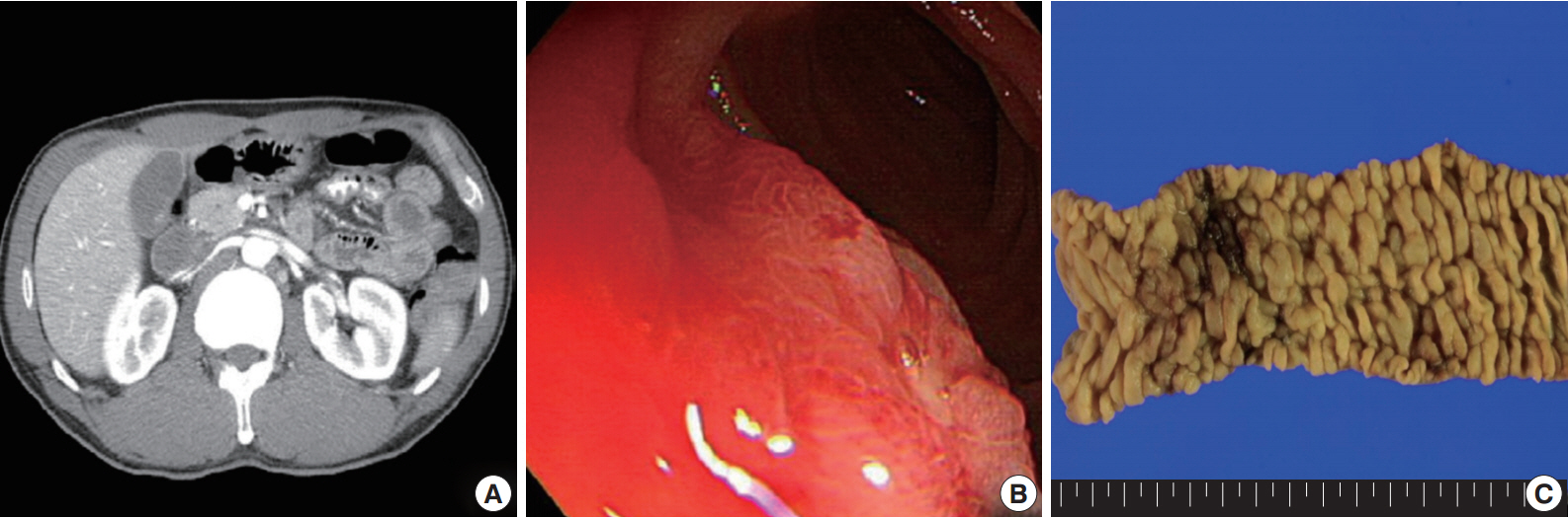 kjpathol-48-6-426f1.jpg