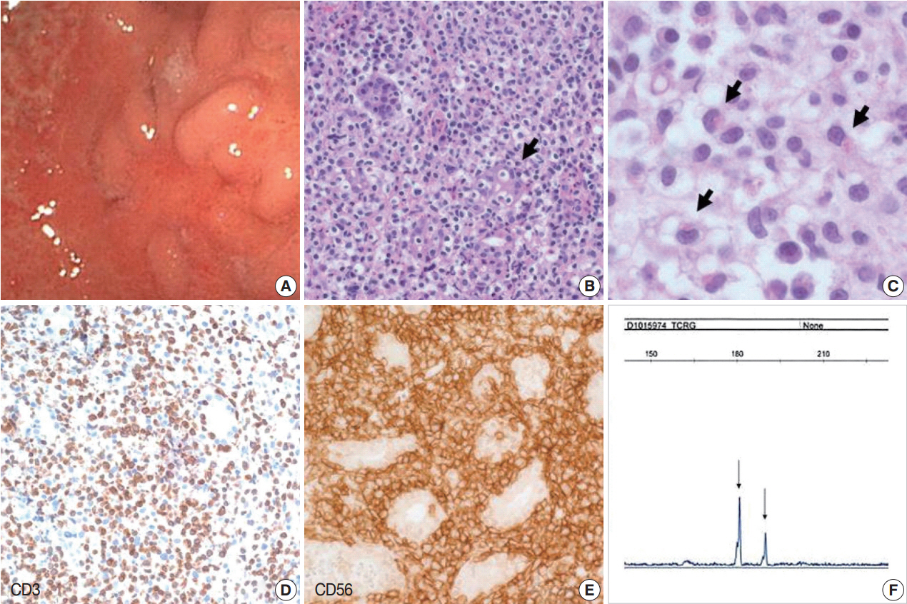 kjpathol-48-6-430f1.jpg