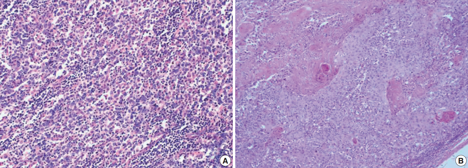 kjpathol-48-6-458f2.jpg