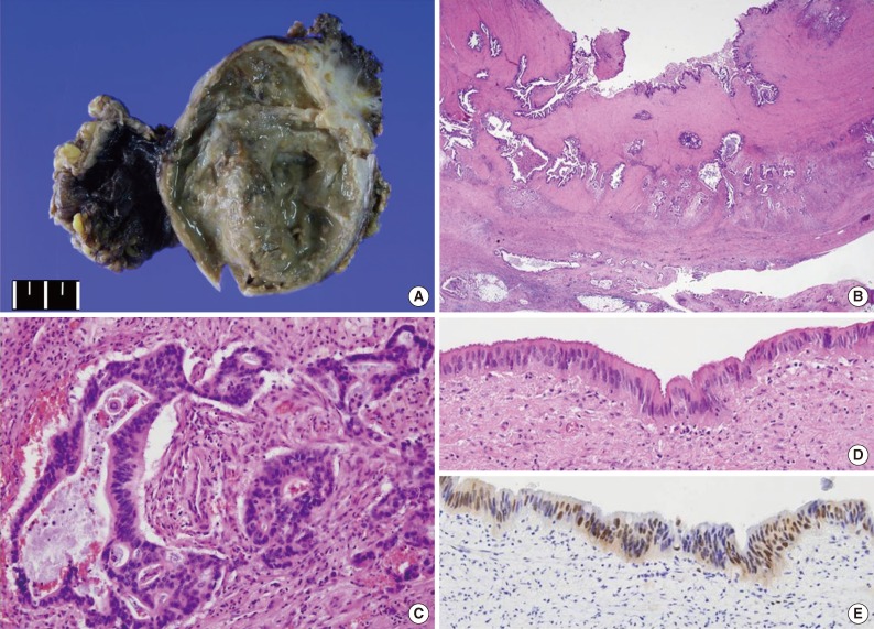 kjpathol-48-62-g002.jpg