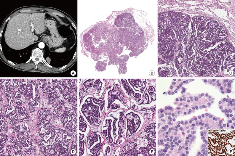 kjpathol-48-66-g001.jpg