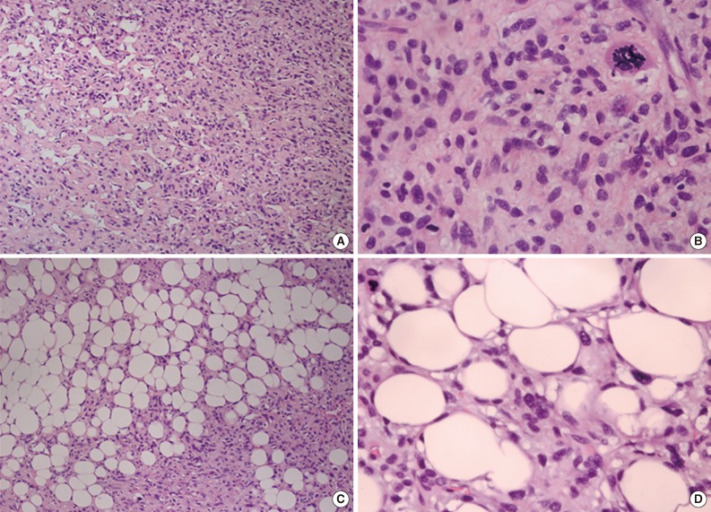 kjpathol-48-69-g002.jpg