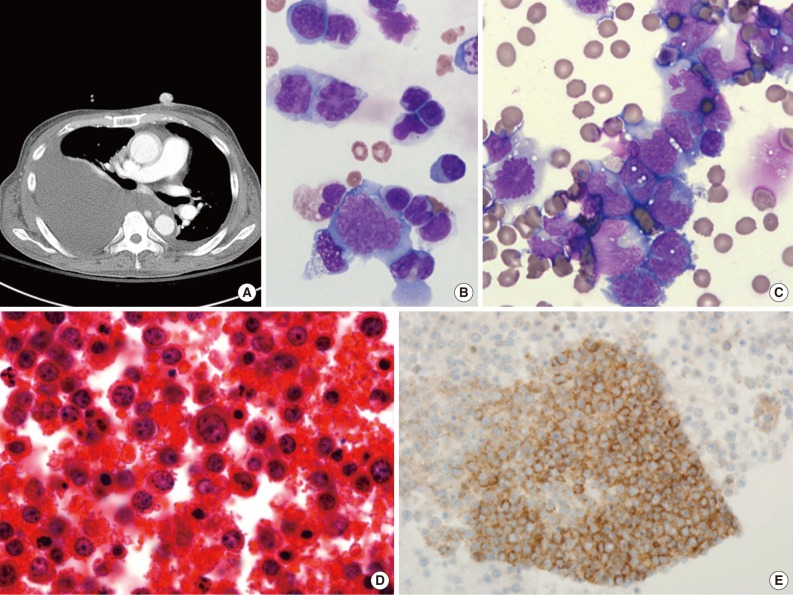 kjpathol-48-81-g003.jpg