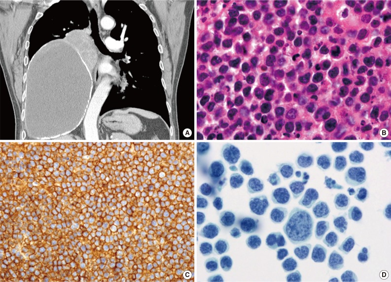 kjpathol-48-81-g004.jpg