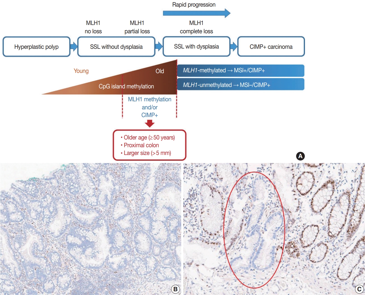 The yield of dysplasia and serrated lesions in a single-centre tertiary  inflammatory bowel disease cohort - Fiona Yeaman, Lena Thin, 2023